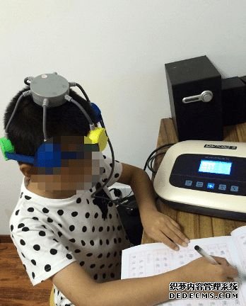 专治疗失眠抑郁等精神疾病制作的择思达斯经颅磁刺激仪 